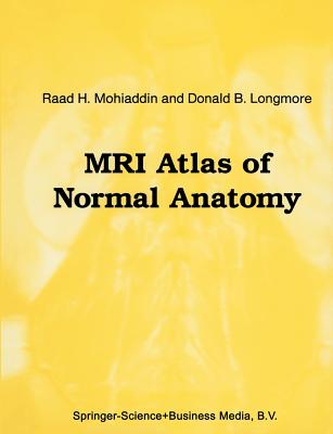 MRI Atlas of Normal Anatomy (Radiology #24) Cover Image