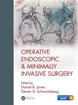 Operative Endoscopic and Minimally Invasive Surgery Cover Image