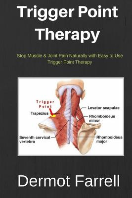 Trigger Point Therapy: Stop Muscle & Joint Pain Naturally with Easy to use Trigger Point Therapy (Natural Health Solutions #3)