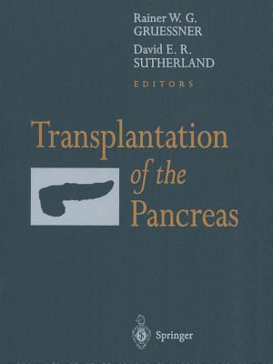 Transplantation of the Pancreas Cover Image
