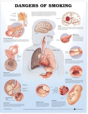 Dangers of Smoking Anatomical Chart By Anatomical Chart Company (Prepared for publication by) Cover Image
