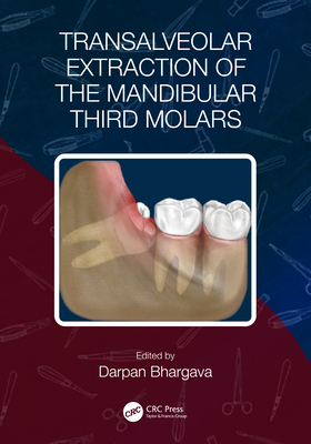 Transalveolar Extraction of the Mandibular Third Molars Cover Image
