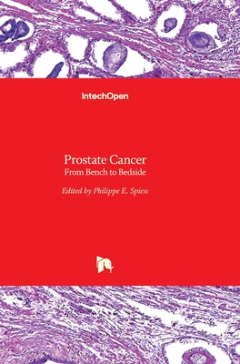 Prostate Cancer: From Bench to Bedside Cover Image