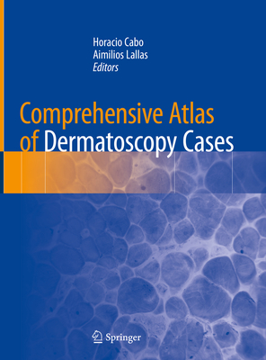 Comprehensive Atlas of Dermatoscopy Cases Cover Image