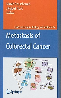 Metastasis of Colorectal Cancer (Cancer Metastasis - Biology and Treatment #14)