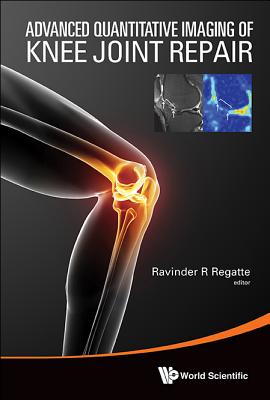 Advanced Quantitative Imaging of Knee Joint Repair Cover Image