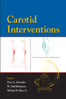 Carotid Interventions Cover Image