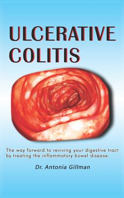 Ulceratlve Colltls: A Way Forward to Reviving Your Digestive Tract by Treating the Inflammatory Bowel Disease Cover Image