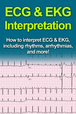 ECG & EKG Interpretation: How to interpret ECG & EKG, including rhythms, arrhythmias, and more! Cover Image