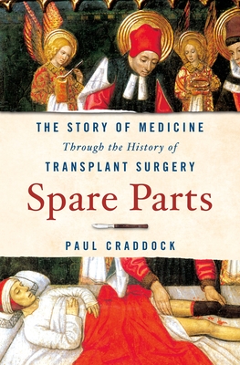 Spare Parts: The Story of Medicine Through the History of Transplant Surgery By Paul Craddock Cover Image