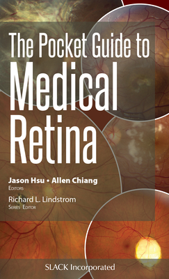 The Pocket Guide to Medical Retina (Pocket Guides) Cover Image