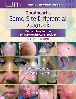 Goodheart's Same-Site Differential Diagnosis: Dermatology for the Primary Health Care Provider Cover Image
