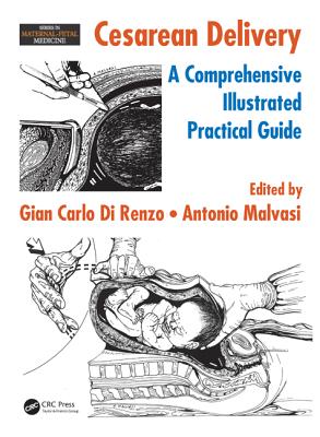 Cesarean Delivery: A Comprehensive Illustrated Practical Guide (Maternal-Fetal Medicine)