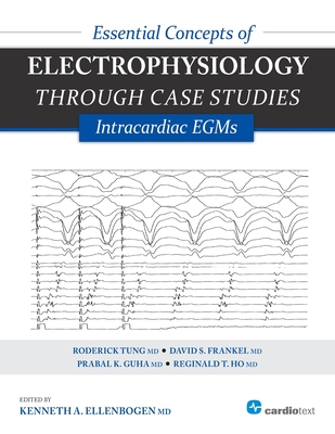 Essential Concepts of Electrophysiology Through Case Studies: Intracardiac EGMs: Intracardiac EGMs Cover Image