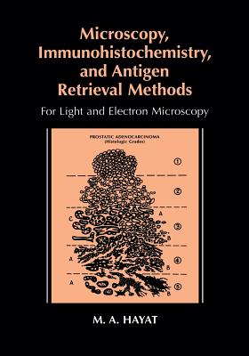 Microscopy, Immunohistochemistry, and Antigen Retrieval Methods: For Light and Electron Microscopy By M. A. Hayat Cover Image