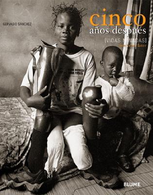 Cinco años después (Vidas minadas): Bilingual edition By Gervasio Sanchez Cover Image