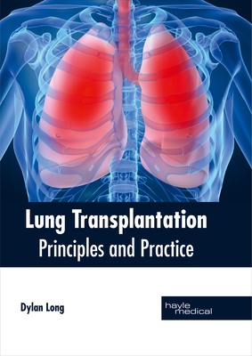 Lung Transplantation: Principles and Practice By Dylan Long (Editor) Cover Image