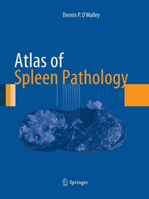 Atlas of Spleen Pathology (Atlas of Anatomic Pathology)