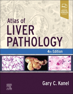 Atlas of Liver Pathology (Atlas of Surgical Pathology) Cover Image