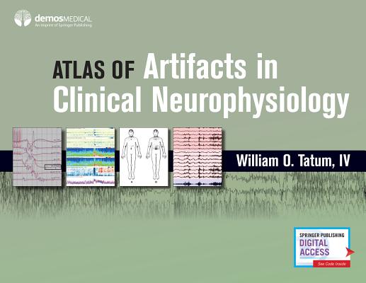Atlas of Artifacts in Clinical Neurophysiology Cover Image