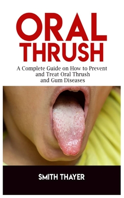 Oral Thrush: A Complete Guide on How to Prevent and Treat Oral Thrush and Gum Diseases By Smith Thayer Cover Image