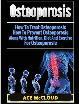 Osteoporosis: How To Treat Osteoporosis: How To Prevent Osteoporosis: Along With Nutrition, Diet And Exercise For Osteoporosis Cover Image