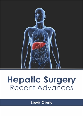 Hepatic Surgery: Recent Advances Cover Image