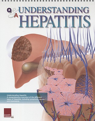 Q&A Understanding Hepatitis (Flip Charts) By Scientific Publishing (Other) Cover Image