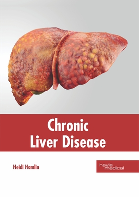 Chronic Liver Disease Cover Image