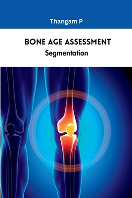 Bone Age Assessment Segmentation Cover Image