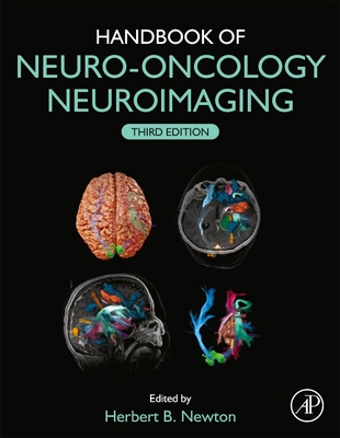 Handbook of Neuro-Oncology Neuroimaging By Herbert B. Newton (Editor) Cover Image