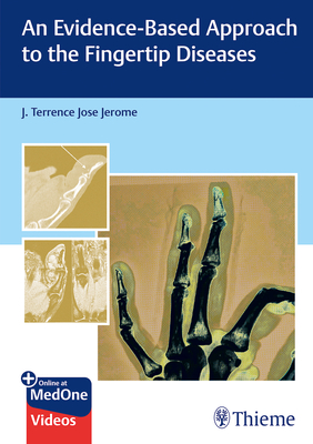 An Evidence-Based Approach to the Fingertip Diseases Cover Image