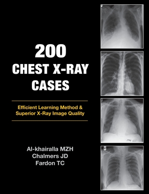 200 Chest X-Ray Cases Cover Image