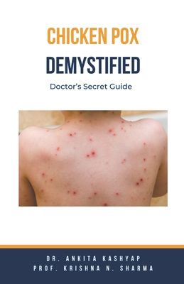 Chickenpox Demystified: Doctor's Secret Guide Cover Image