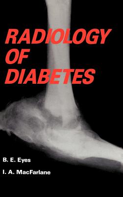 Radiology of Diabetes By B. Eyes, I. MacFarlane Cover Image