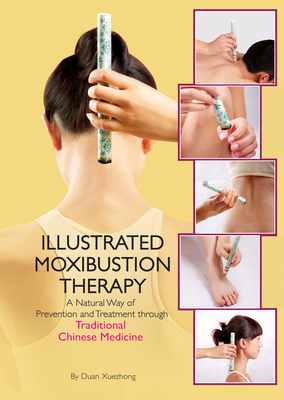 Illustrated Moxibustion Therapy: A Natural Way of Prevention and Treatment through Traditional Chinese Medicine Cover Image