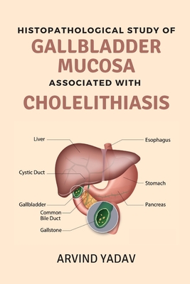 Histopathological Study of Gallbladder Mucosa Associated With Cholelithiasis Cover Image