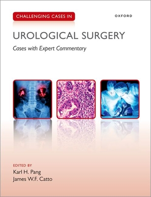 Challenging Cases in Urological Surgery Cover Image