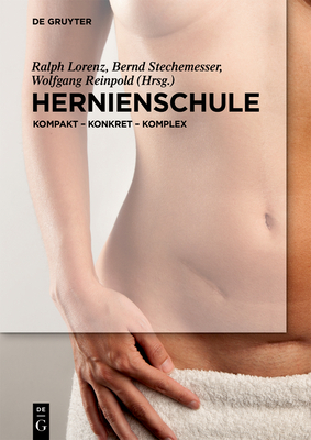 Hernienschule: Kompakt - Konkret - Komplex Cover Image