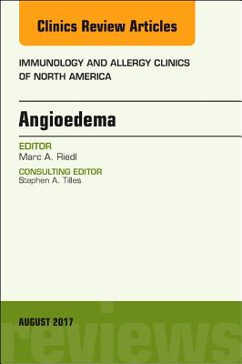 Angioedema, an Issue of Immunology and Allergy Clinics of North America: Volume 37-3 (Clinics: Internal Medicine #37) Cover Image