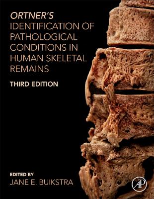 Ortner's Identification of Pathological Conditions in Human Skeletal Remains Cover Image