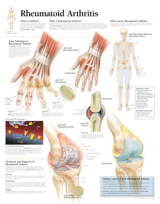 Rheumatoid Arthritis: Wall Chart Cover Image
