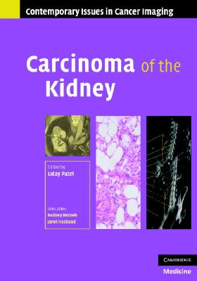 Carcinoma of the Kidney (Contemporary Issues in Cancer Imaging) Cover Image