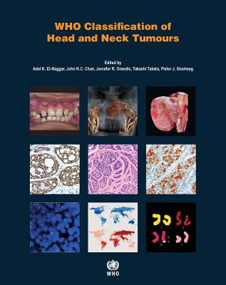 WHO Classification of Head and Neck Tumours (WHO Classification of Tumours)