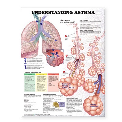 Understanding Asthma Anatomical Chart By Anatomical Chart Company (Prepared for publication by) Cover Image