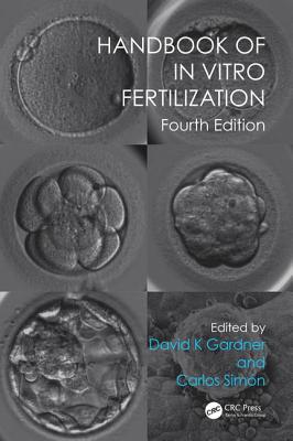 Handbook of in Vitro Fertilization Cover Image