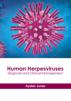Human Herpesviruses: Diagnosis and Clinical Management Cover Image