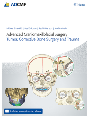 Advanced Craniomaxillofacial Surgery: Tumor, Corrective Bone Surgery, and Trauma By Michael Ehrenfeld (Editor), Neal D. Futran (Editor), Paul Manson (Editor) Cover Image