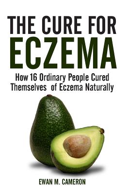 The Cure for Eczema By Ewan M. Cameron Cover Image