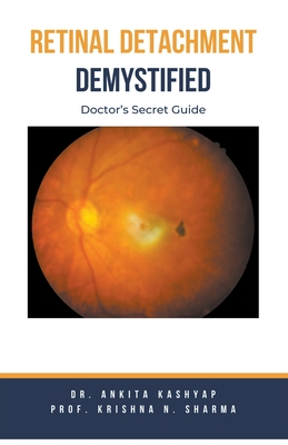 Retinal Detachment Demystified: Doctor's Secret Guide Cover Image